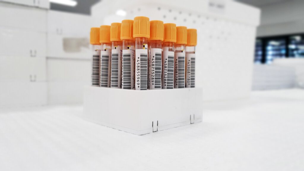 Pre-analytical sample processing: SST blood tubes